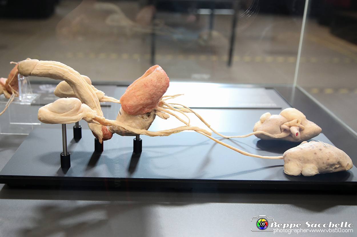 VBS_2570 - Prostata ingrossata - Mostra Body Worlds.jpg